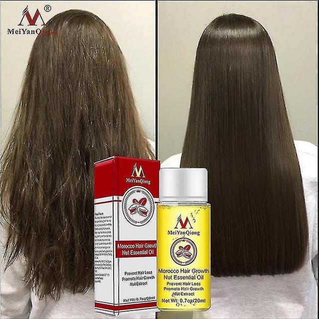 christina show Sl Chang Fast Powerful Hair Growth Essence Productos para la pérdida de cabello Tratamiento líquido de aceite esencial Prevenir on Productcaster.