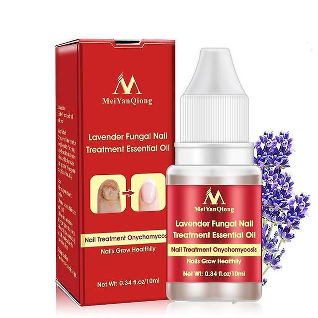 Qian Chinese Cream Nails Finger Toe Protector Fungus Treatment Herb Health Tools Onychomycosis Paronychia Infection Skin Care on Productcaster.