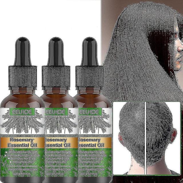 high-quality 3pcs Rosemary Oil For 100% Nourishes on Productcaster.