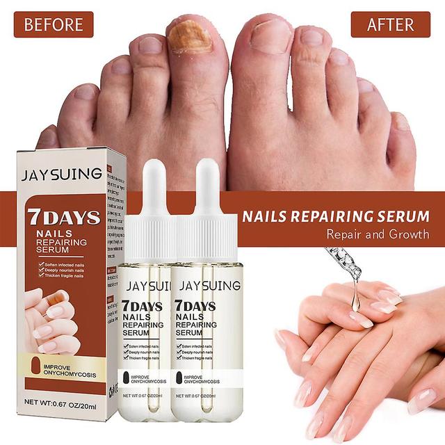 2pcs 7 Days Nail Growth And Strengthening Serum, Nail Growth And Strength Serum on Productcaster.