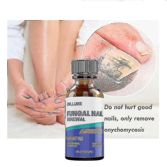 Hot Nail Fungus Treatment Stop Fungal Growth Effective Fingernail & Toenail Health Care Solution Fix & Renew Damaged Cracked 10ml on Productcaster.