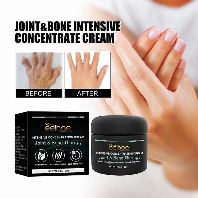 Eelhoe Joint Care Cream allevia il piede alluce valgo cervicale dolore articolare massaggio crema per la cura on Productcaster.