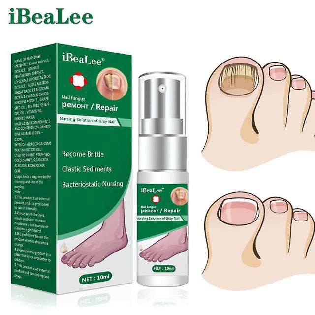 Liečba plesní nechtov Essence Toe Repair Gél na odstránenie plesní nechtov Kúpiť 1 získať 3 on Productcaster.