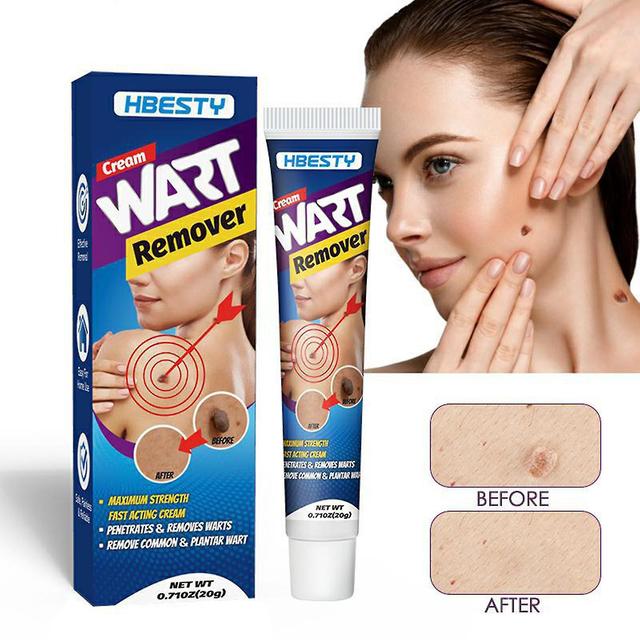 20g Repair Wart Cream Trace-less Non-irritating Fast Effect External Use Nourish Skin Care Tool Effective Wart Remover Treatment Cream For Neck on Productcaster.