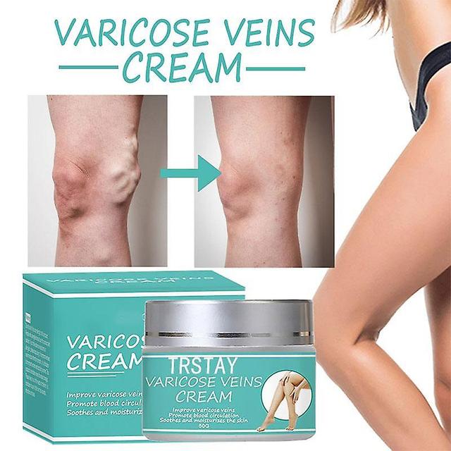 Face Cream Of Varicose Veins Institutes, Vasculitis Of The Legs, Phlebitis, Spider, Ointment Of Institutes, Medical Plaster, Body Health Care 5g on Productcaster.