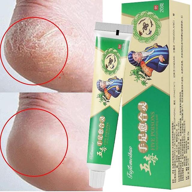 Anti-fissure Cream For Herbs For Feet, Dry Mask For Feet, Repair Of Cracks In Heel, Hand Cream, Elimination Of Calluses, Dead Skin, Feet on Productcaster.