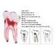 Easyget 12 Size 1:1 Dental Rct Endo Training Teeth Model 3d Curved Root Teeth Model Lower Molar A-1PC on Productcaster.