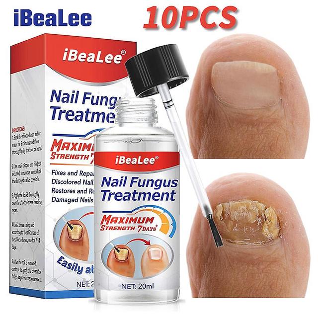 Ibealee-training Of The Nauts, Repaintiving Fuster, Anti-infection, Feet Care, Antifungal Frost, Onychomycosis Oil, 7 Days, 10 Pieces 8PC on Productcaster.