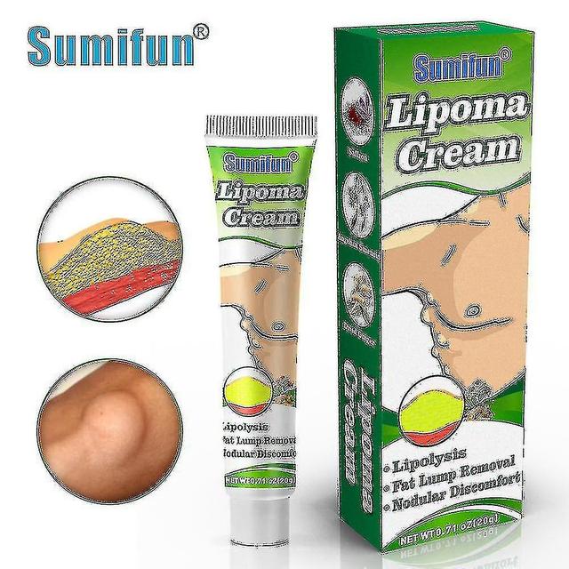 20g/st Sumifun Lipoma Removal Cream Mot Papler Av Fettenhet Anti-Fettvävnad Hyperplasi Växtbaserade Detox Hälsovård Tw Mvivi on Productcaster.