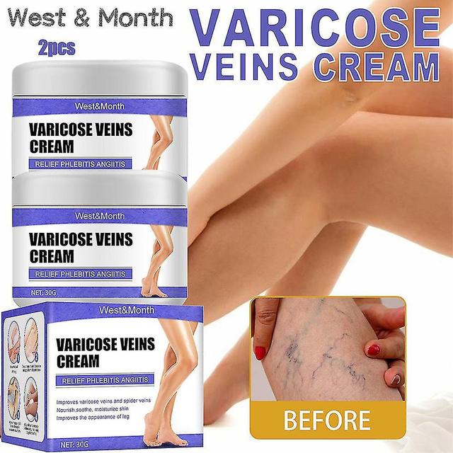 Hitoor 2pcs 30g Vein Repair Cream Vein Pain Varicose Veins Earthworm Leg Care Cream on Productcaster.