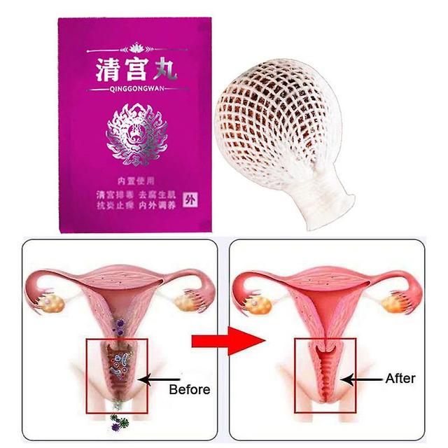 1 Tablet Of Chinese Herbal Medicine Vaginal Anti-inflammatory Women's Detoxification Pearl Qinggong Pill For Women's Health Care on Productcaster.