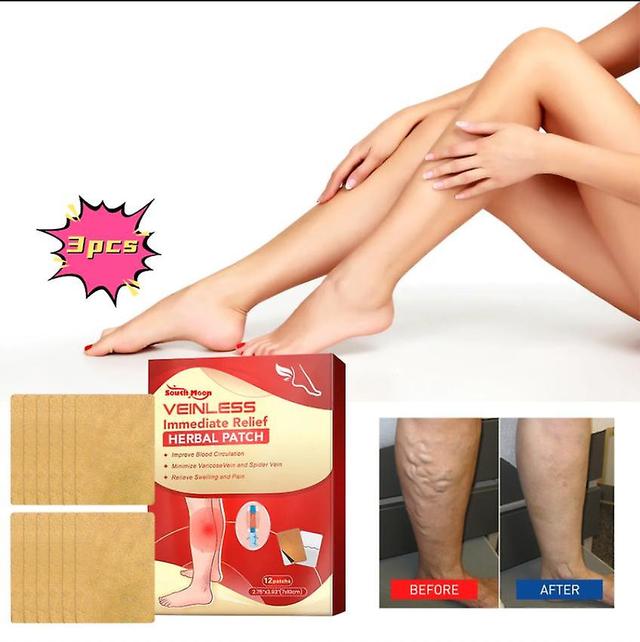 South Moon Varicose Care Herbal Patch Leg Massage Relieve Soreness Earthworm Leg Vein Care Patch Massage Oil1PCS) 3PCS on Productcaster.