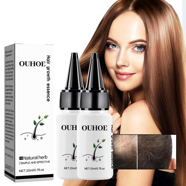 Szbght 1/2/3pcs Hair Growth Essence Advanced Thinning Hair & Hair Loss Supplement 30ml 20ml 2PCS on Productcaster.