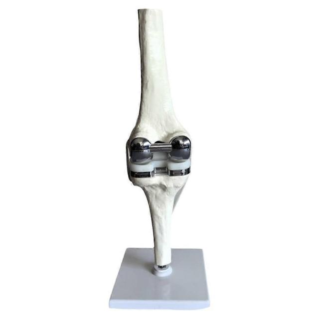 Knee Joint Model Simulation Replacement Surgery Meniscus Ligament Cartilages Surgery Model,Artifici Photo Color on Productcaster.