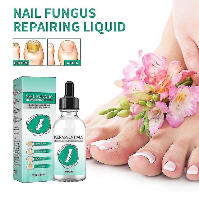 2pcsx30ml Toenail Fungus Tratamento, pele saudável, unhas de cabelo para o fungo da unha do pé on Productcaster.