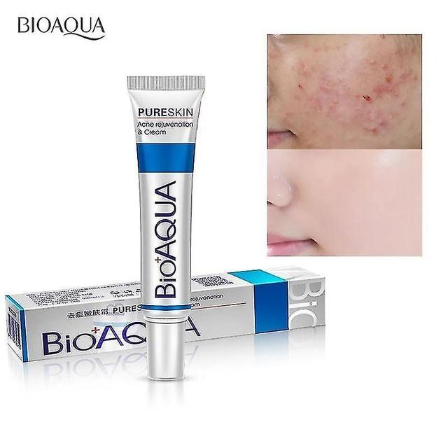 Bioaqua-face Anti-acne Cream, Cosmetic Product, Treatment Of Black Dots, Blocked Skin And Pores, Whitening Treatment, 30 G, 1 Room, Hk on Productcaster.