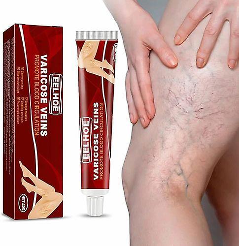 Varicose Veins Cream Relief Phlebitis Angiitis Inflammation Blood Vein Veins on Productcaster.