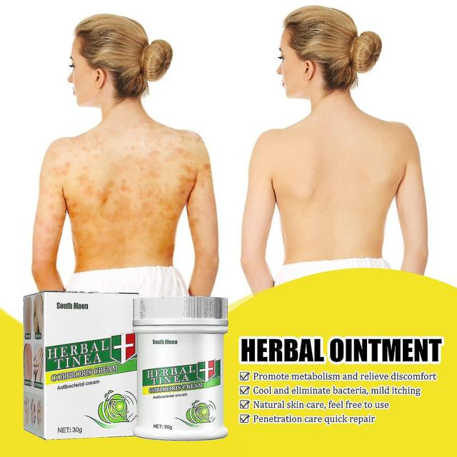 Bio Kräuter Tinea Corporis Creme Tinea Haut Erleichterung Juckreiz Creme Kräuterformel Sanfte und nicht irritierende Tinea Versicolor on Productcaster.