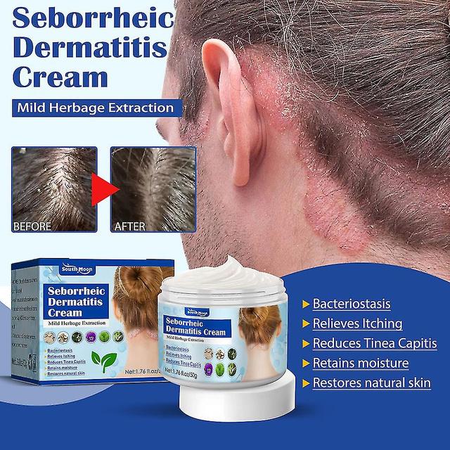 Seborrheic Skin Cream Hoved Acne Kløe Hovedbund Ringorm Hud Problem Repai Beroligende Hovedhud on Productcaster.