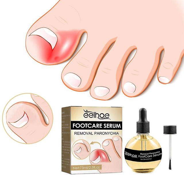 Remove Paronychia Oil, Fight Paronychia And Improve Toenail Health on Productcaster.