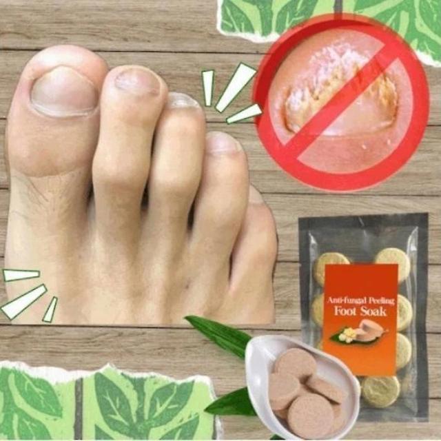 10 stks Ginger Foot Soak Bruistabletten DIY Foot Spa Peeling Effect Improve Sleeping Foot Care 10st on Productcaster.