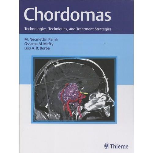 Chordomas - Technologies, Techniques, And Treatment Strategies on Productcaster.