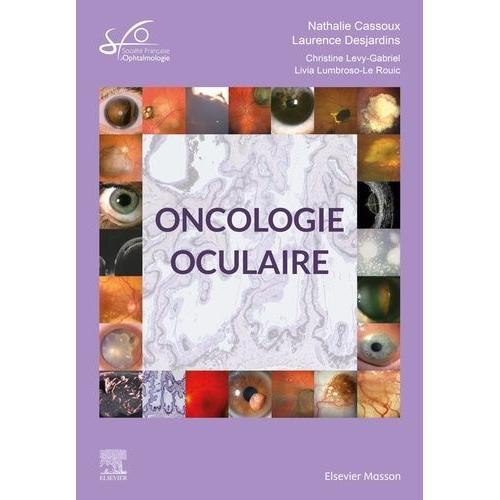 Oncologie Oculaire on Productcaster.