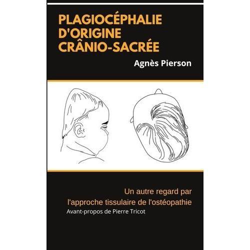 Plagiocéphalie D'origine Crânio-Sacrée - Un Autre Regard Par L'appr... on Productcaster.