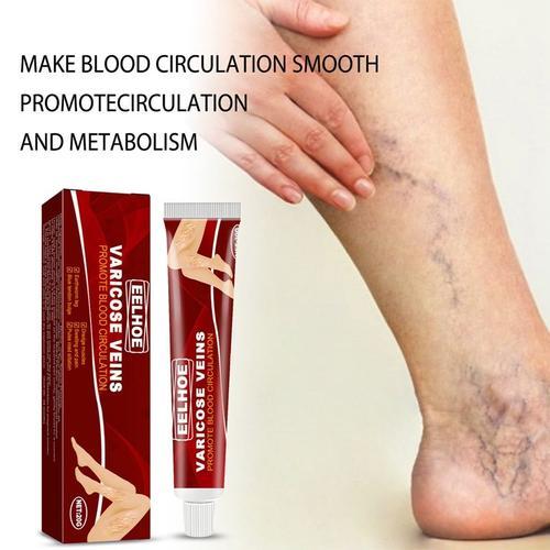 Crème De Traitement Des Varices, Pommade Efficace Contre La Vascula... on Productcaster.