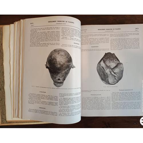 Encyclopédie Médico-Chirurgicale - Obstetrique 2 Volumes on Productcaster.