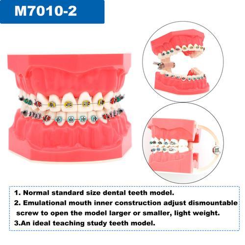 Modèle Dentaire Standard,Modèle Dentaire,Implant Orthodontique Fuch... on Productcaster.