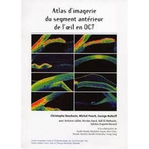 Atlasd'imagerie Du Segment Antérieur De Ll'oeil En Oct.Collection L... on Productcaster.