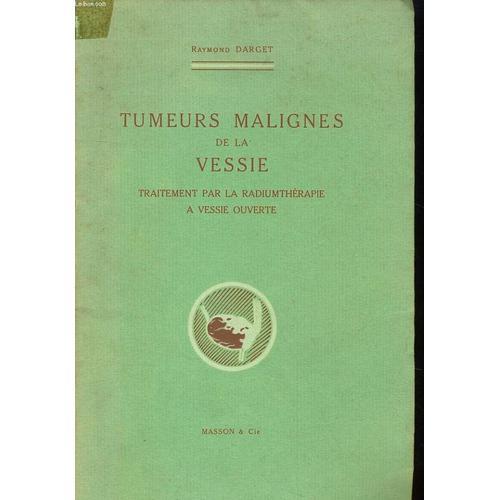 Tumeurs Malignes De La Vessie - Traitement Par La Radiumtherapie A ... on Productcaster.