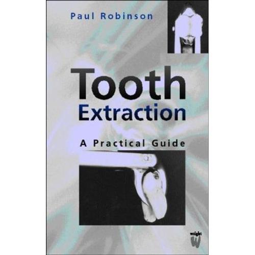 Tooth Extraction: A Practical Guide on Productcaster.