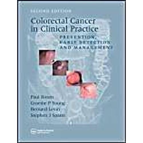 Colorectal Cancer In Clinical Practice: Prevention, Early Detection... on Productcaster.